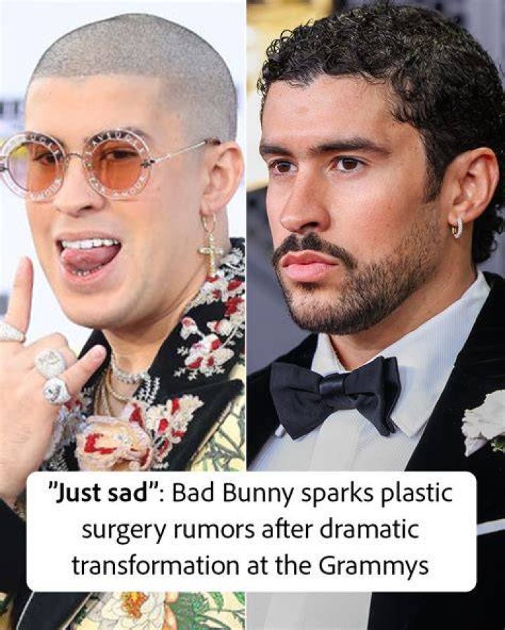 Bad Bunny’s Plastic Surgery The 29YearOld Rapper Looks A Little