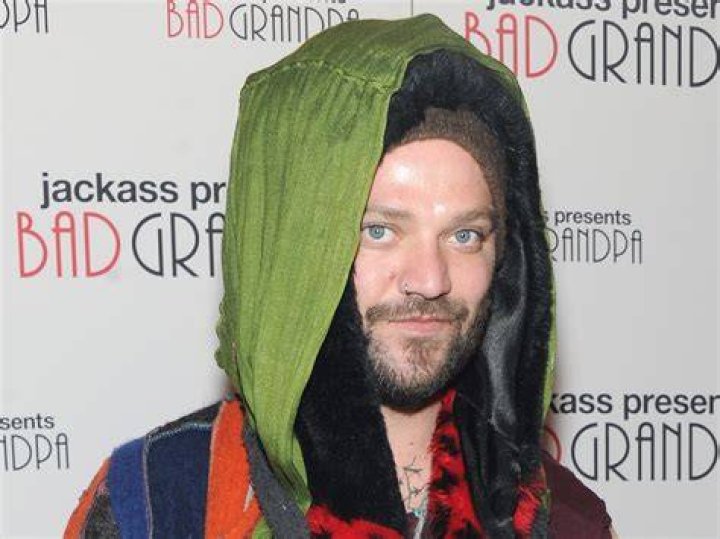 BAM MARGERA Hospitalized With Pneumonia & COVID, On Ventilator But Stable