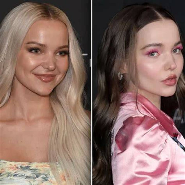 Beautiful Celebrities, Favorite Celebrities, Dove And Thomas, Dove