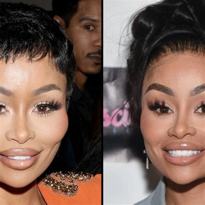 Blac Chyna Before Plastic Surgery: Uncovering Hidden Truths