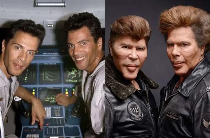 bogdanoff brothers plastic surgery
