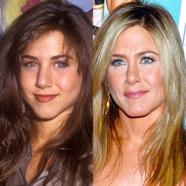Celebrities Who Got a Nose Job to Fix Their ''Deviated Septum'' E! News