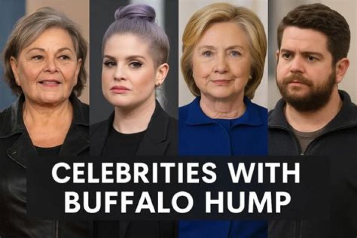 Celebrities with Buffalo Hump Surprising Cases