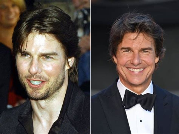 Celebrity Smiles Revealed Tom Cruise &bull; Stouffville SMILES Dentistry