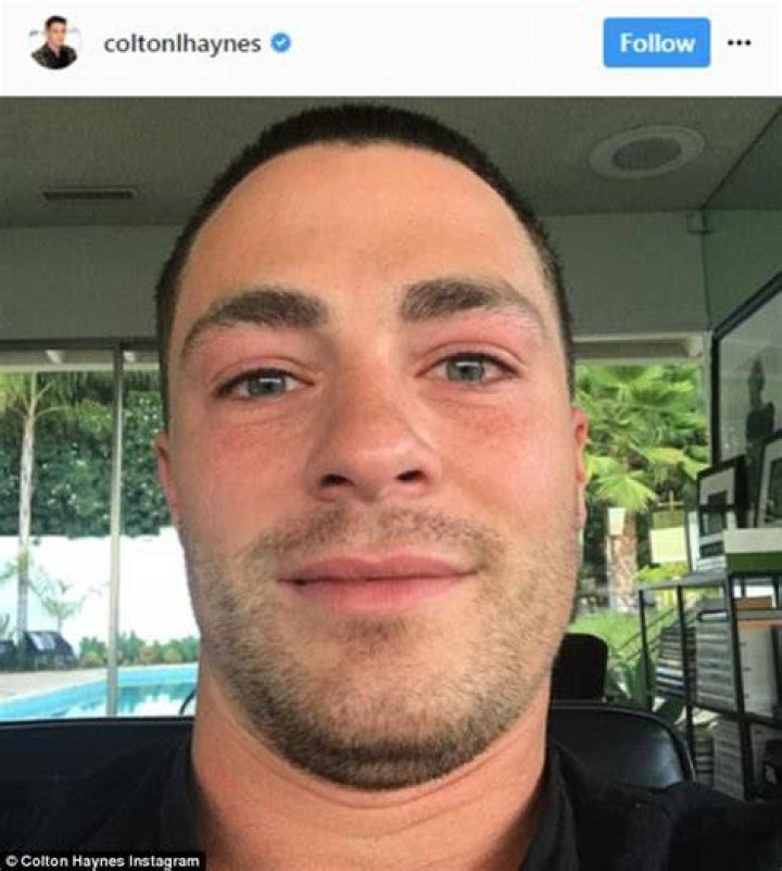 Colton Haynes details his long battle with depression Daily Mail Online