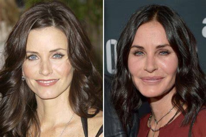 Courteney Cox on bad face work 'I'm looking really strange'