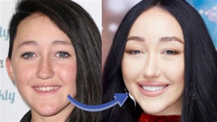 Did Noah Cyrus Ever Have Plastic Surgery? See the Singer&rsquo;s