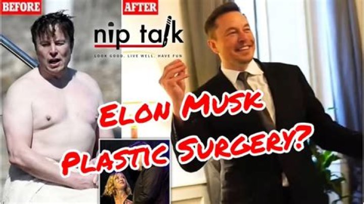 Elon Musk Plastic Surgery: Fact or Fiction? 1 Elon Musk Plastic Surgery: Fact or Fiction?