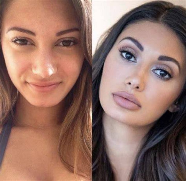 Francesca Farago Health After Plastic Surgery Before