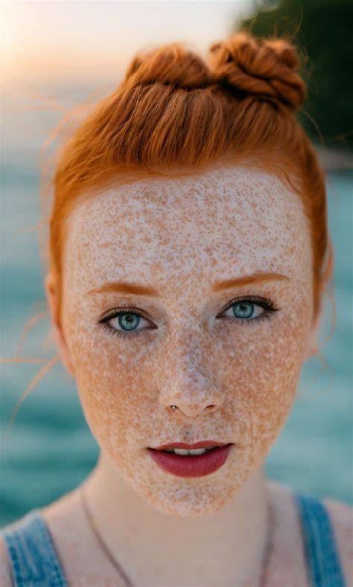 Ginger Hair, Cosplay Girls, Freckles, Redheads, Red Hair, Mini Dress