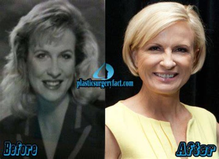 Has Mika Brzezinski Had Plastic Surgery? Body Measurements and More