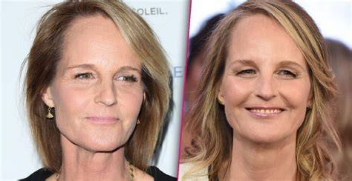 Helen Hunt Erased Her Wrinkles at Age 56 How Did She Do It? Verge Campus
