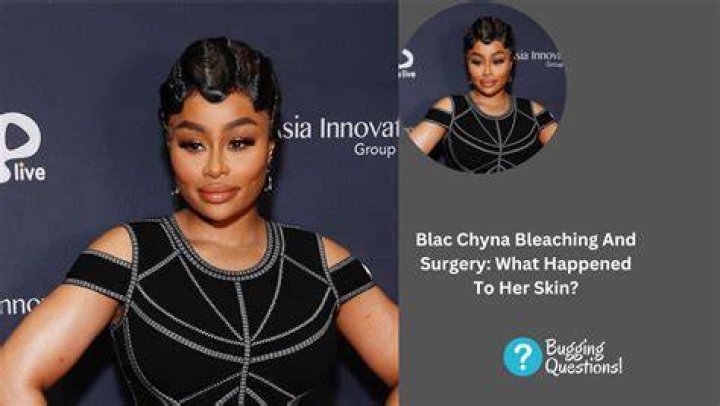 How To Prevent Blac Chyna Only Fans Leaked