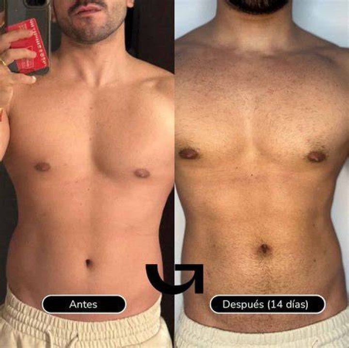 Impresionante el antes y el después de Lyn May La Opinión