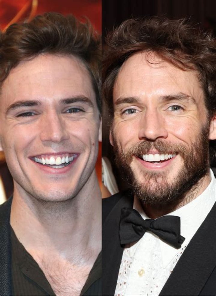 Is Sam Claflin Teeth Reason Behind His Pearly Smile?