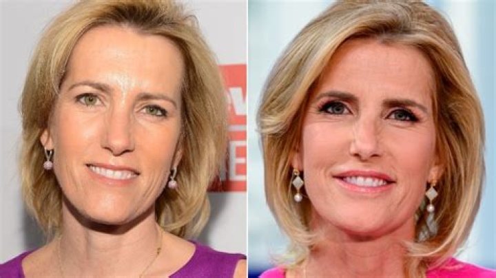 Laura Ingraham Plastic Surgery Botox, Body Measurements, Nose Job