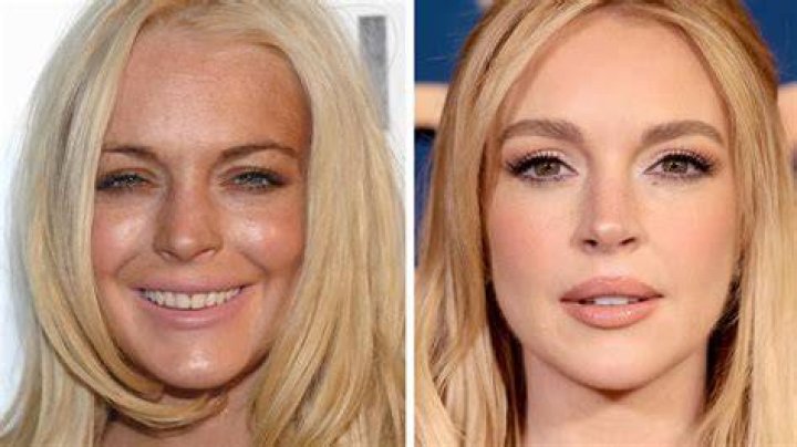 Lindsay Lohan Before Plastic Surgery