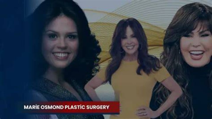 Marie Osmond Plastic Surgery: How She Maintains Her Youthful Looks 1 Marie Osmond Plastic Surgery: How She Maintains Her Youthful Looks
