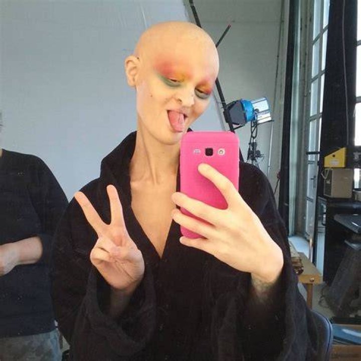 Meet Melanie Gaydos, 28YearOld Model With A Rare Disorder Who