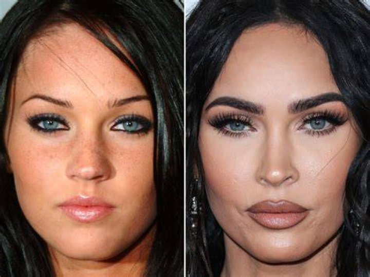 Megan Fox Plastic Surgery Is It Just A Rumour? Longevita
