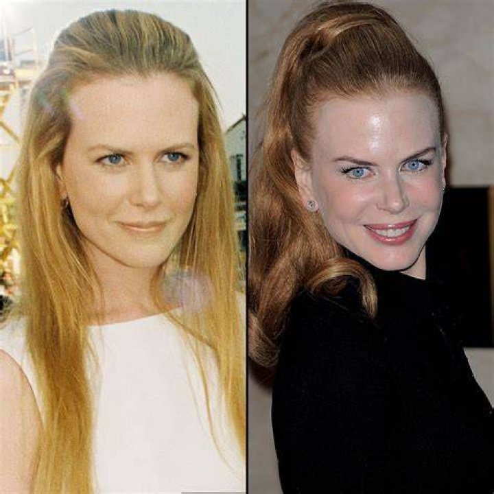 Nicole Kidman's Divorce Celebration Picture Remains Absolutely Iconic