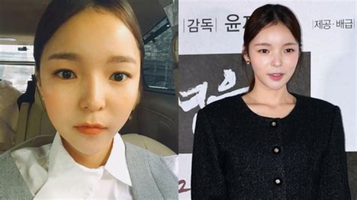 Park Jin Joo Plastic Surgery What Is Her Secret of Beauty?