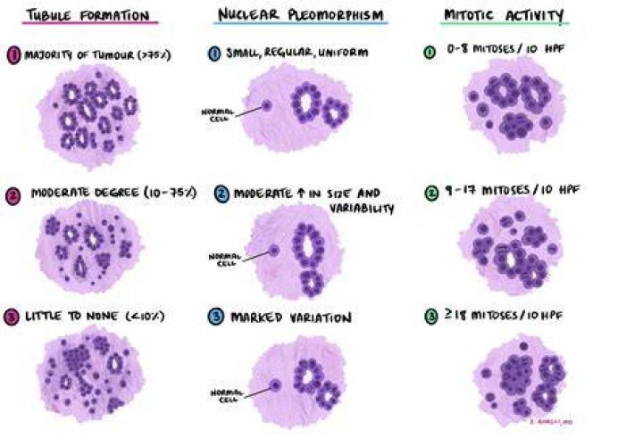 Pathology Outlines Brian Martens, D.O.