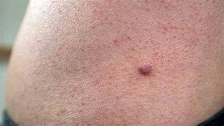 Pin on m&aring;neskin