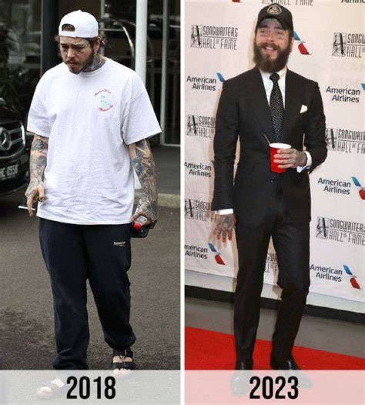 Post Malone Weight Loss [2023] Actual Story Revealed