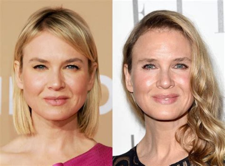 Ren&eacute;e Zellweger Explains Why Her Face Looks Different People Don't