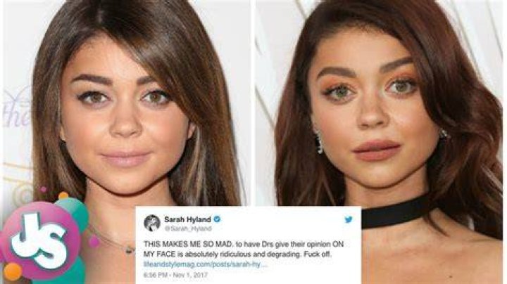 Sarah Hyland Slams Plastic Surgery Rumors, Confirms Her 'Modern CBS
