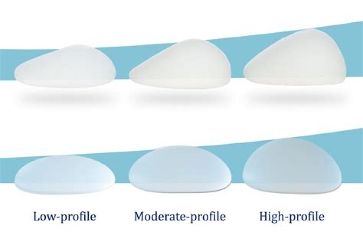 Silicone breast implants still lack proof of safety Fox News