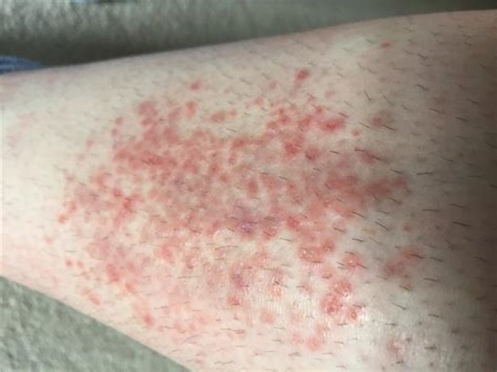Skin Conditions, Explained WARSOOR