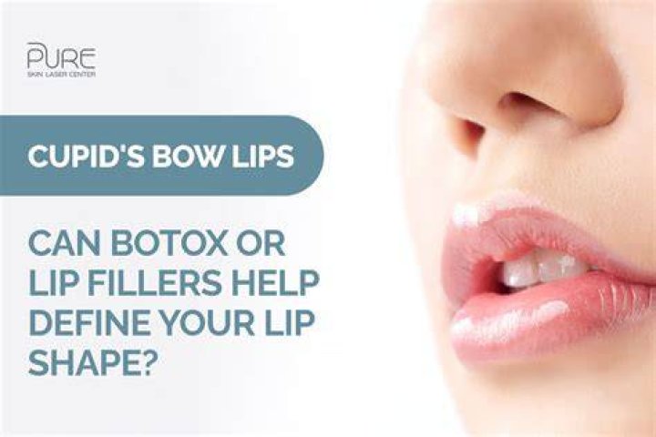 The Cupid&rsquo;s Bow Lip Treatment Aestha Clinic