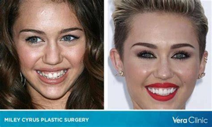 Tish Cyrus Plastic Surgery Before And After Photos