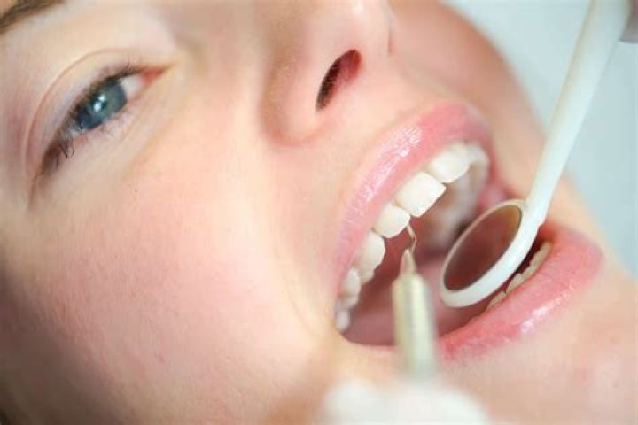 Treatment Options For Fixing a Gap Between Teeth Tompkins Dental