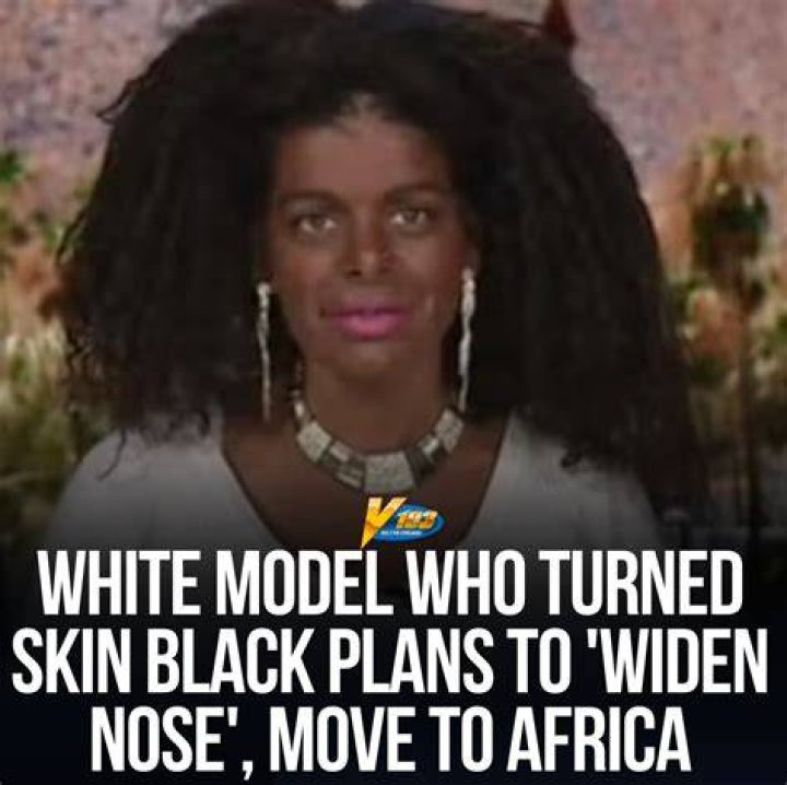 White model who 'changed race' reckons she's 'empowering' black women