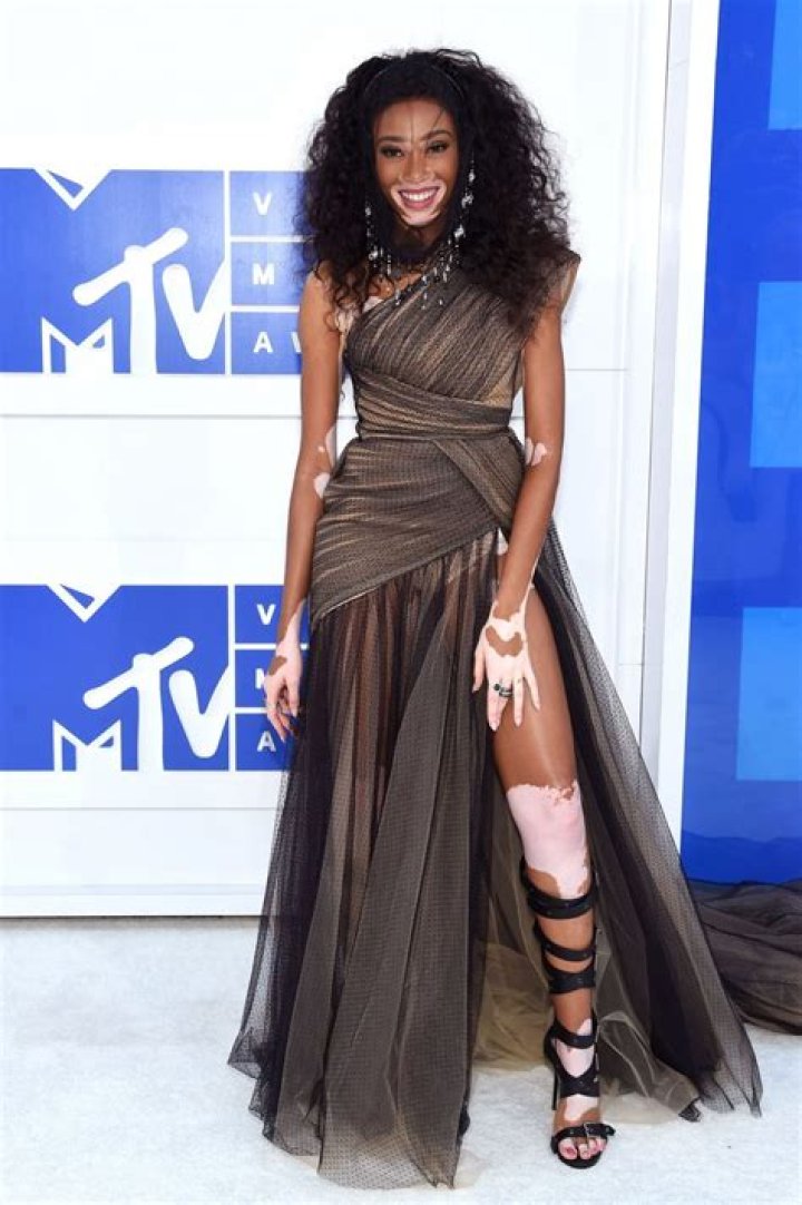 Winnie Harlow Opens Up About Early Days of Dating Kyle Kuzma