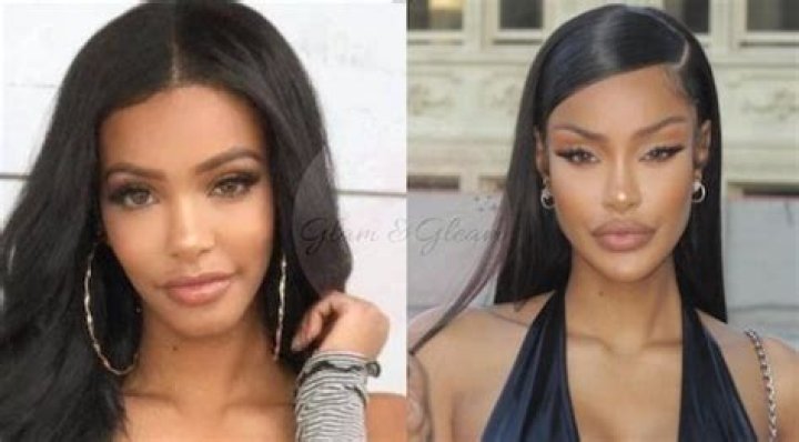 Yodit Yemane Plastic Surgery Before And After Pics, Age And Boyfriend