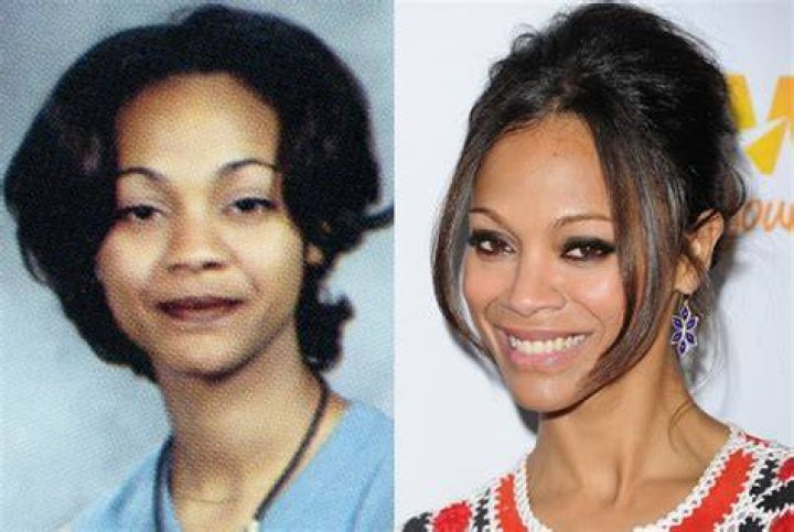 Zoe Saldana before and after a nose job.